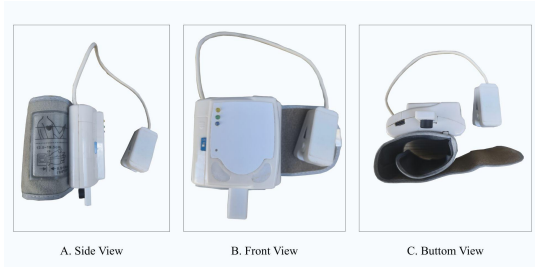 Final prototype of the smart wearable patient monitoring device, shown from the side, front, and bottom views. The device combines the wearable blood pressure unit with integrated sensors and supporting hardware for monitoring patient vital signs.